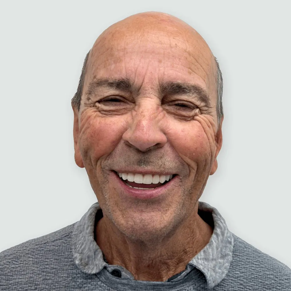 The patient smiling after treatment at The Veneer Clinic